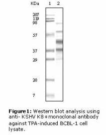 Monoclonal Mouse anti-Human Herpesvirus 8 HHV-8 K8 alpha Antibody (clone 8C12G10G1, IHC, WB)