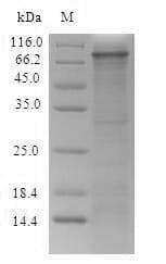 Rat ITGB4 / Integrin Beta 4 Protein (Recombinant 6His-SUMO, N-terminus)
