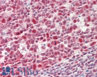 IHC-plus™ TIP120 / CAND1 Antibody (aa1180-1230)