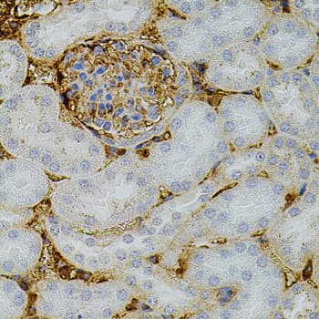 NTF3 / Neurotrophin 3 Antibody