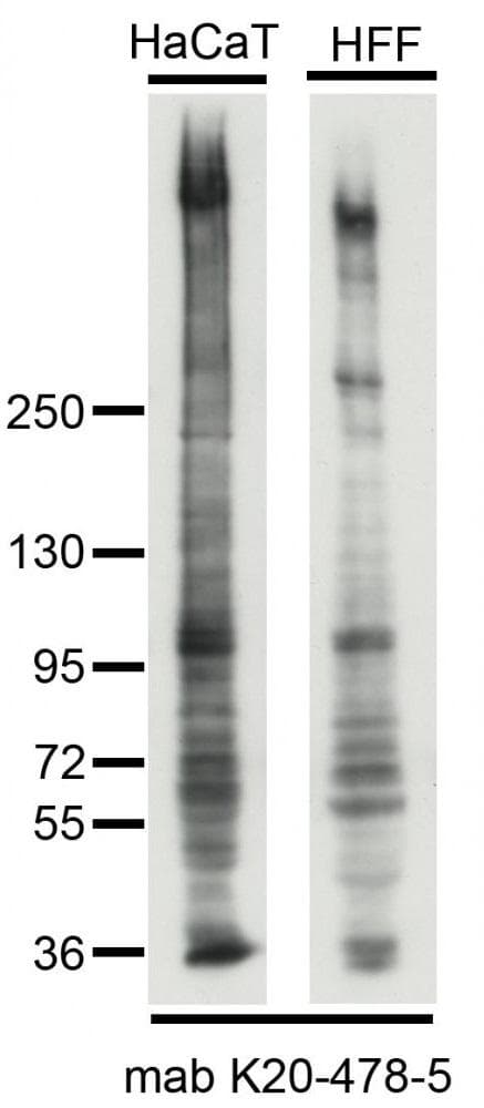 Monoclonal Mouse anti-Human SYNE2 / Nesprin-2 Antibody (clone K20-478-5, IF, WB)