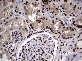 Monoclonal Mouse anti-Human NBN / Nibrin Antibody (clone OTI8E7, IHC, WB)