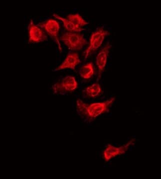 Polyclonal Rabbit anti-Human ADAMTS2 Antibody (IF, WB)