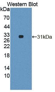 TOP1MT Antibody