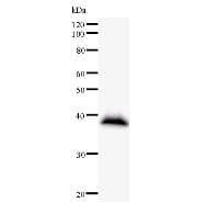 Monoclonal Mouse anti-Human GTF3C2 Antibody (clone 2395C2a, IF, WB)