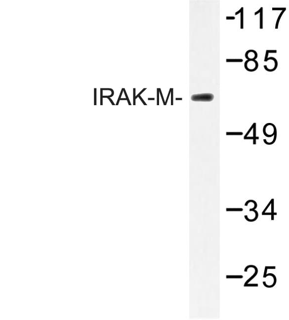 IRAK3 / IRAKM / IRAK-M Antibody (Leu519)