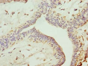 Polyclonal Rabbit anti-Human TRIM13 Antibody (IHC, WB)