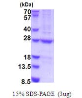 Human N6AMT1 Protein (Recombinant His)
