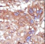 TNK2 / ACK1 Antibody (aa934-964)