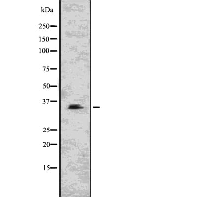CNN1 / Calponin Antibody