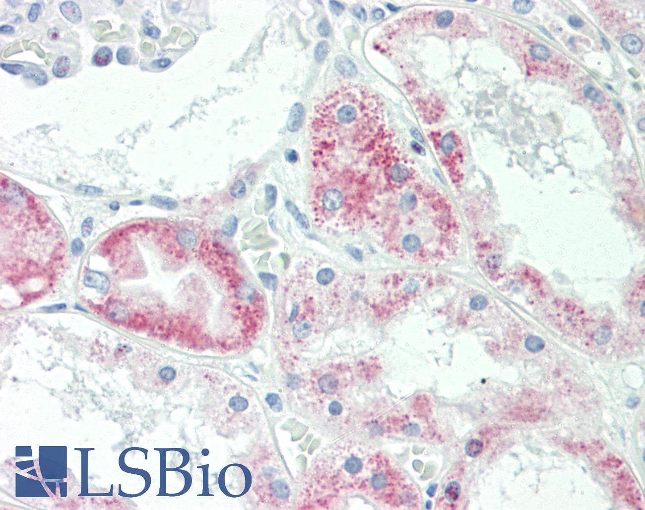 IHC-plus™ SLC22A6 / OAT1 Antibody (aa513-541)