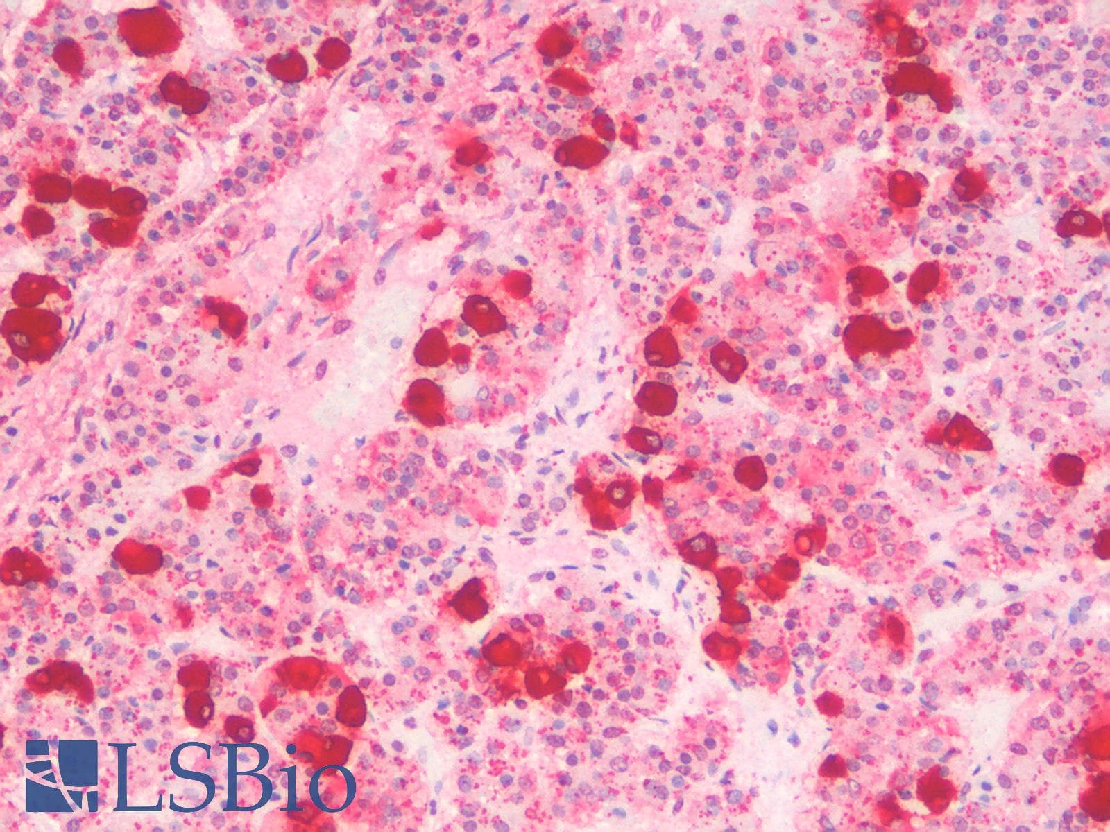 PathPlus™ p16INK4a / CDKN2A Antibody (aa1-60)
