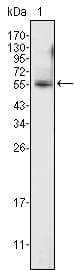 IHC-plus™ PEA3 / ETV4 Antibody (clone 1A2G3)