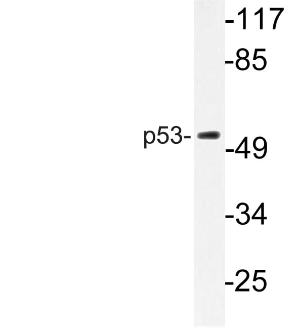 TP53 / p53 Antibody (Arg375)