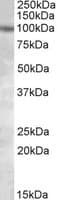 PKD2 / Polycystin 2 Antibody (aa871-883)