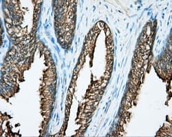 Monoclonal Mouse anti-Human DNTTIP1 / TDIF1 Antibody (clone OTI1F4, IHC, IF, WB)
