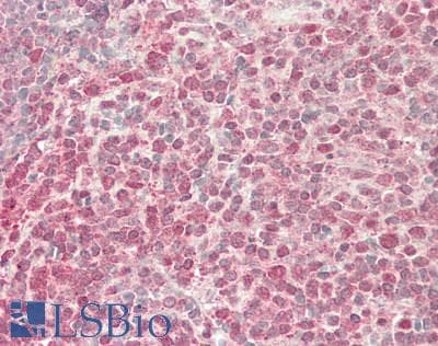 IHC-plus™ Polyclonal Rabbit anti-Mouse DFFA / ICAD / DFF45 Antibody (IHC, IF, WB)