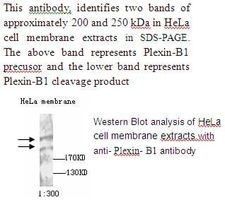 IHC-plus™ PLXNB1 / Plexin-B1 Antibody