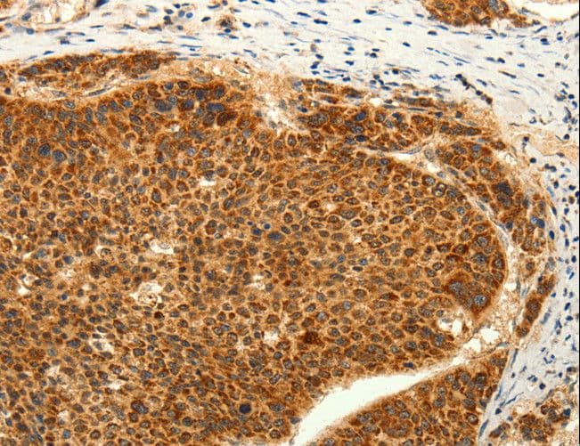Polyclonal Rabbit anti-Human TRPC6 Antibody (IHC)