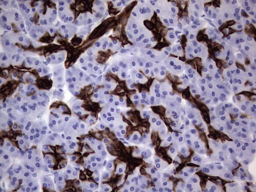 Monoclonal Mouse anti-Human KRT19 / CK19 / Cytokeratin 19 Antibody (clone OTI1E7, aa240-390, IHC)