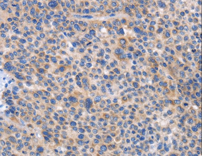 Polyclonal Rabbit anti-Human CARD17 / INCA Antibody (IHC)