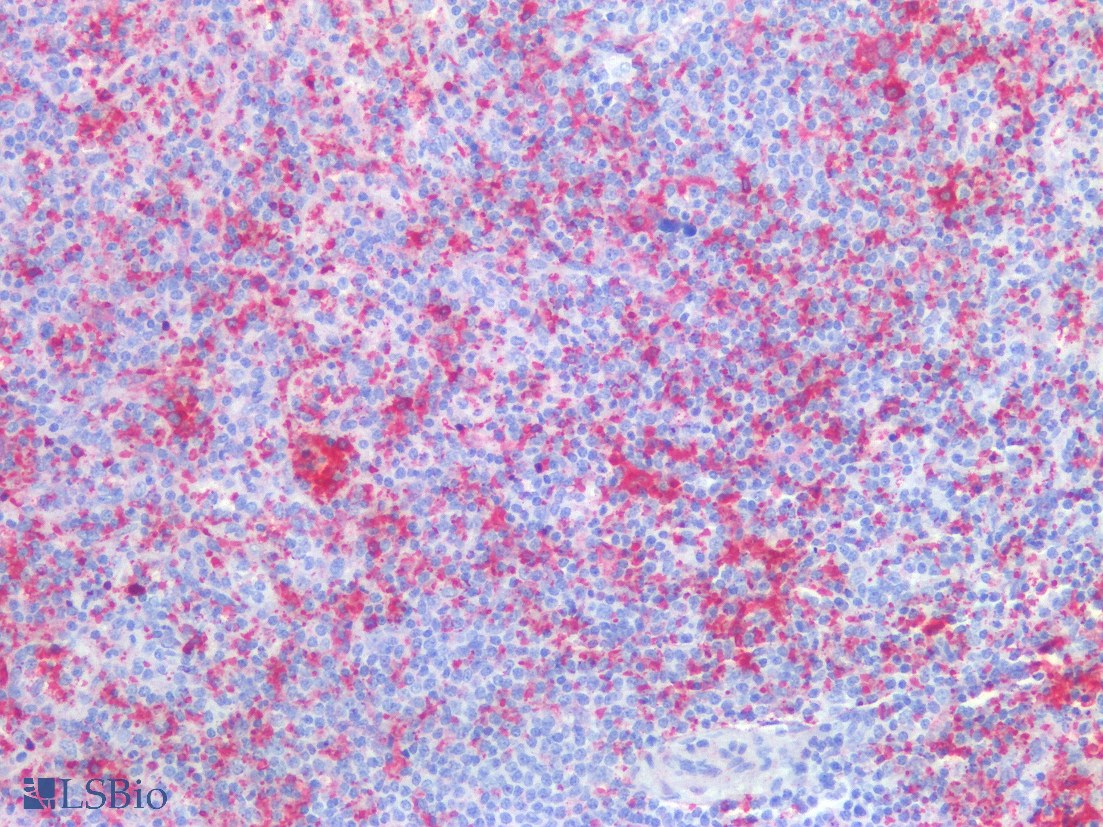 PathPlus™ HBA2 / Hemoglobin Alpha 2 Antibody