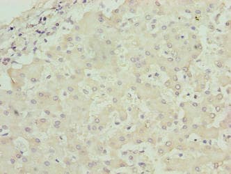 RPL7L1 Antibody