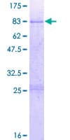 Human ABLIM3 Protein (Recombinant GST)