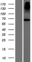 ACCSL Protein (Over-Expression Lysate Myc-DDK (Flag))
