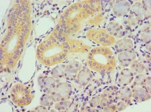 TBRG1 Antibody (aa22-150)