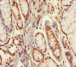 Polyclonal Rabbit anti-Human GPX8 Antibody