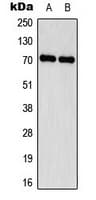 SCNN1D Antibody (Internal)
