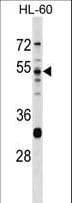 PRSS16 Antibody (aa52-81)