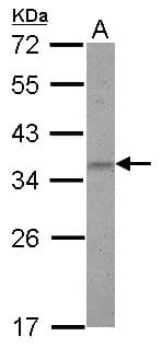 ZNF501 Antibody