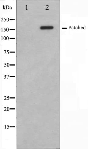 Polyclonal Rabbit anti-Human PTCH1 / Patched 1 Antibody (IHC, IF, WB)