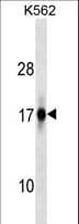 ZFAND2A Antibody (aa70-99)