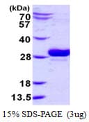 Human UBC6 / UBE2J2 Protein (Recombinant His)