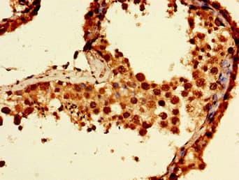 NCMAP / C1orf130 Antibody