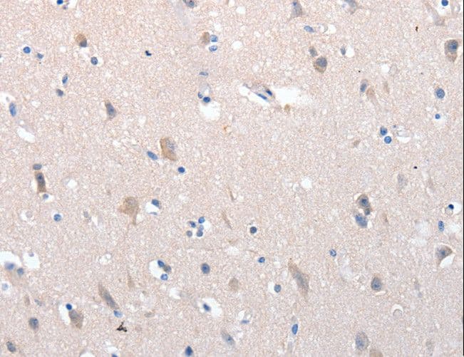 Polyclonal Rabbit anti-Human YWHAG / 14-3-3 Gamma Antibody (IHC, WB)
