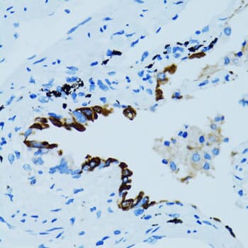 Polyclonal Rabbit anti-Human CTSE / Cathepsin E Antibody (IHC, IF, WB)