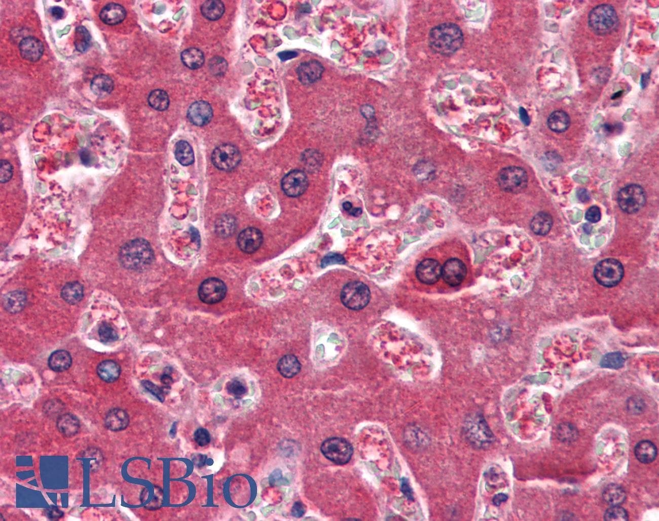 IHC-plus™ RBP4 Antibody (aa19-201, clone AT2B4)