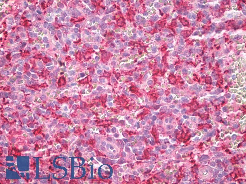 IHC-plus™ HMOX1 / HO-1 Antibody (aa1-30)