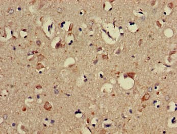 Polyclonal Rabbit anti-Human PPP2R3A / PR130 Antibody (IHC)
