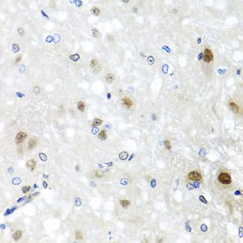 SAFB2 Antibody