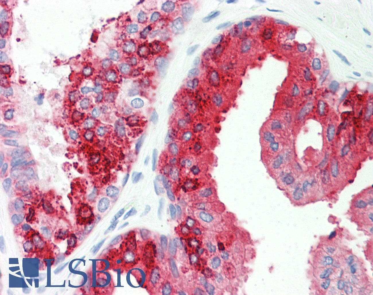 IHC-plus™ HSPA5 / GRP78 / BiP Antibody (Gly584)