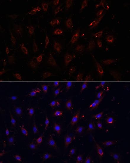 NFKBIA / IKB Alpha / IKBA Antibody