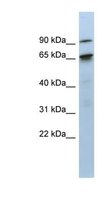 KIAA0427 / CTIF Antibody (aa71-120)