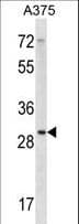 RPLP0 Antibody (aa1-30)