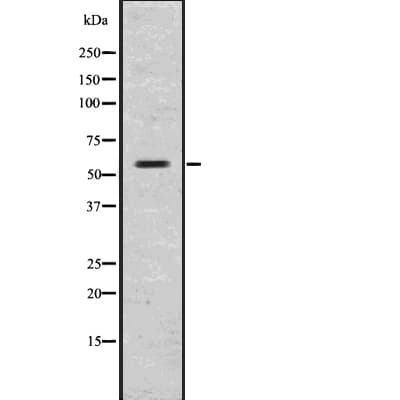 GLP1R / GLP-1 Receptor Antibody
