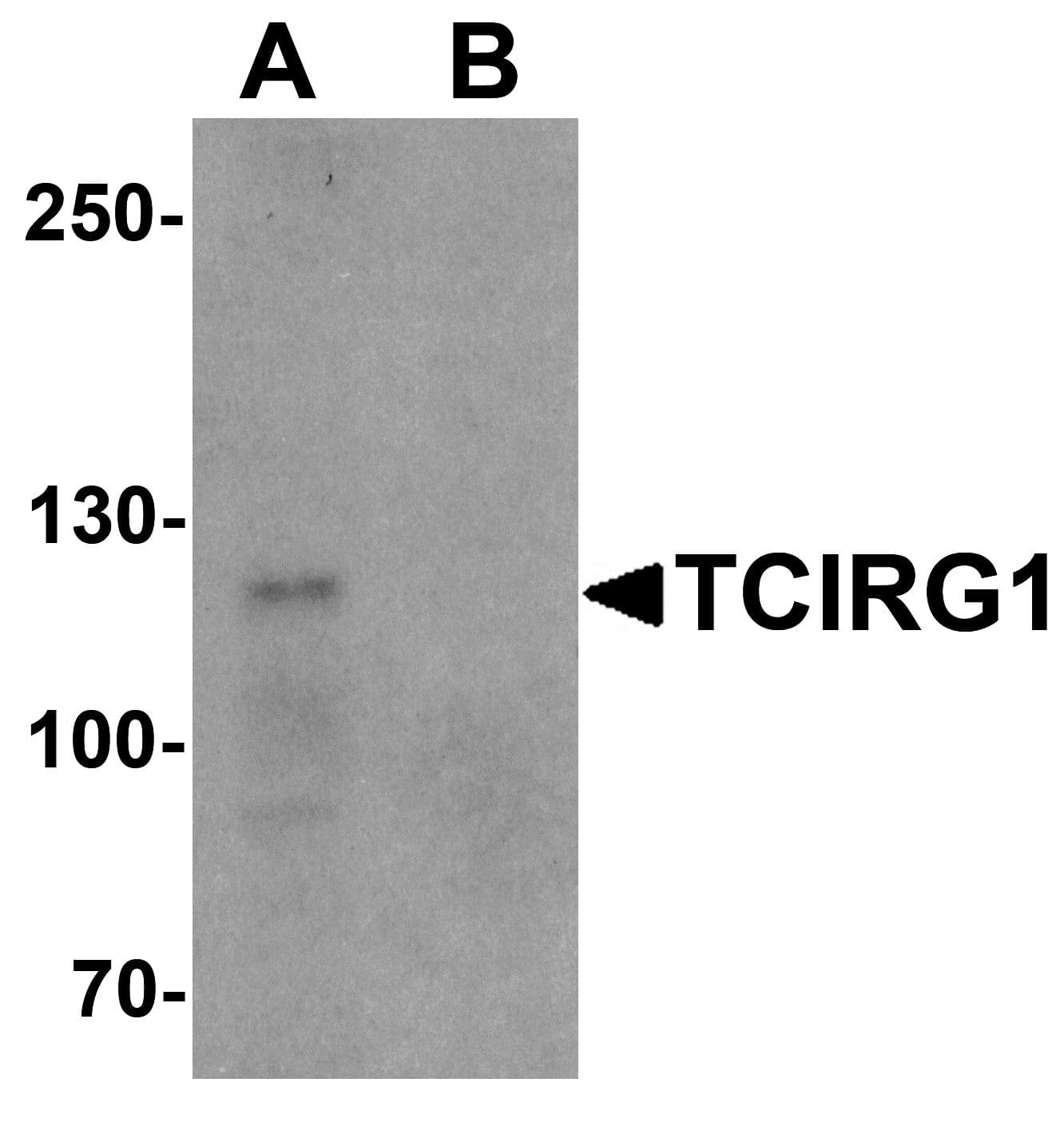 TIRC7 / TCIRG1 Antibody